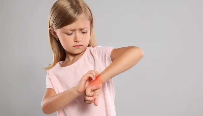 Une petite fille se gratte le poignet, le visage plissé par une forte démangeaison aux mains.