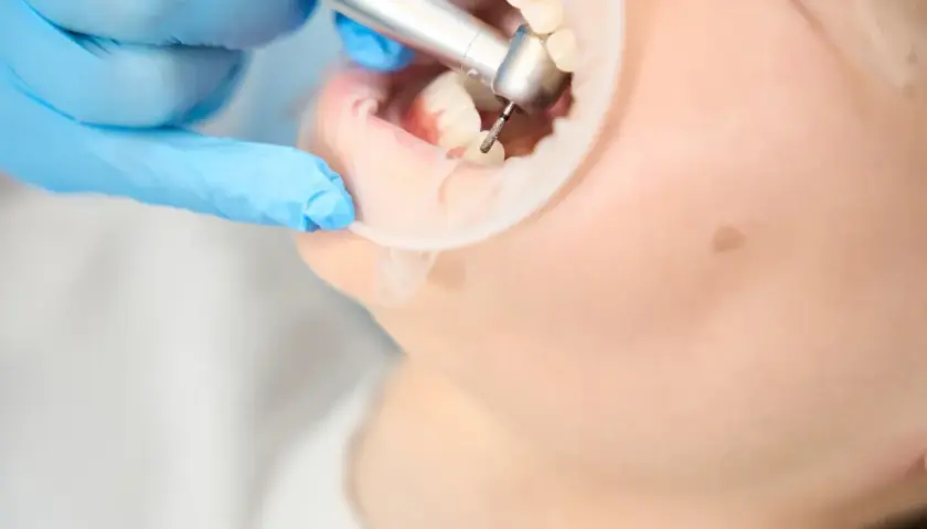 Ile trwa wizyta u dentysty? Poznaj czas trwania różnych zabiegów