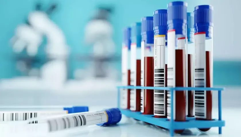 Próbówki z krwią w stojaku, gotowe do analizy. W tle mikroskopy, sugerujące badania laboratoryjne, być może w kierunku odczyn biernackiego.