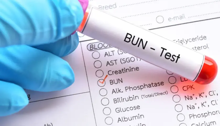 Rękawiczka w niebieskiej rękawiczce trzyma probówkę z napisem "BUN - Test". Zaznaczono opcję BUN, co oznacza badanie mocznika we krwi.