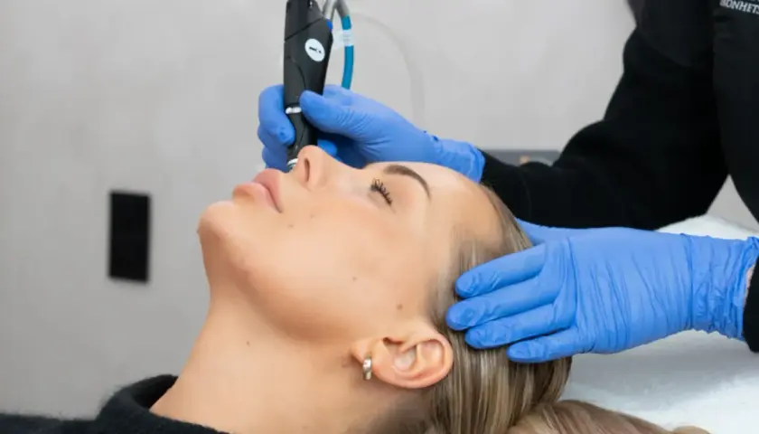 En kvinna får ansiktsbehandling med en fractional CO2 laser för hudförbättring.