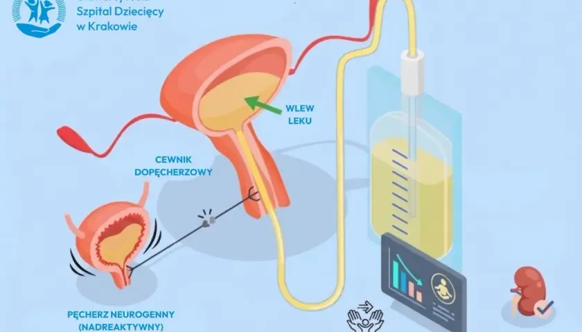 Ilustracja przedstawia pęcherz neurogenny, cewnik dopęcherzowy i system do wlewu leku, wskazując na ochronę nerek i łatwą aplikację w domu.