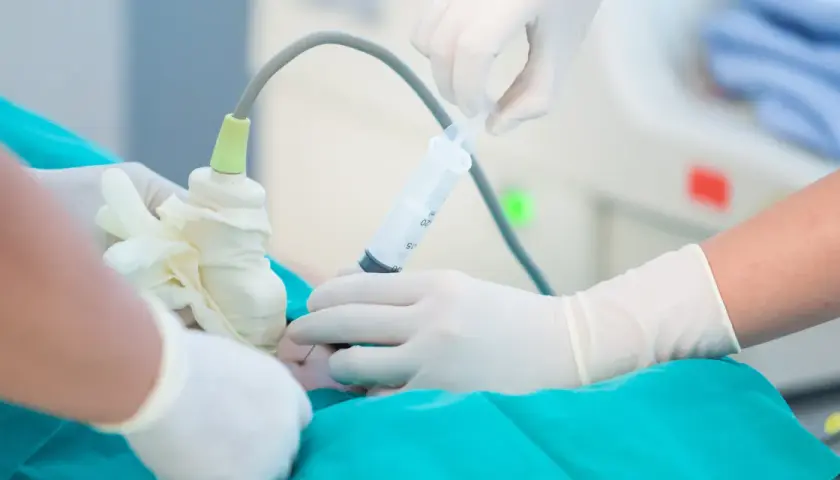 Mani guantate eseguono amniocentesi, un esame diagnostico che si fa solitamente tra la 15ª e la 20ª settimana di gravidanza.