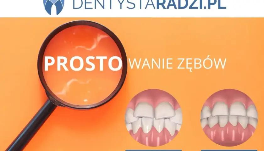 Proste wyrównanie zębów dzięki aparatowi ortodontycznemu. Przed i po leczeniu.