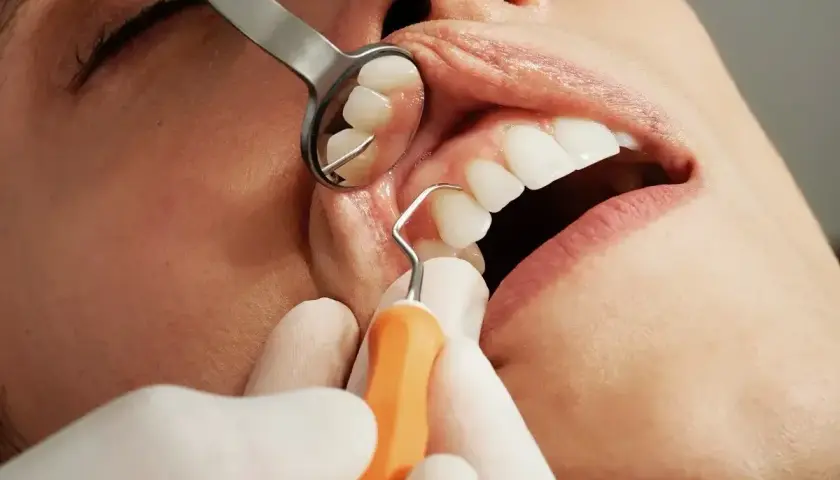 Dentysta bada zęby, widoczna jest duża dziura w zębie, która wymaga leczenia.