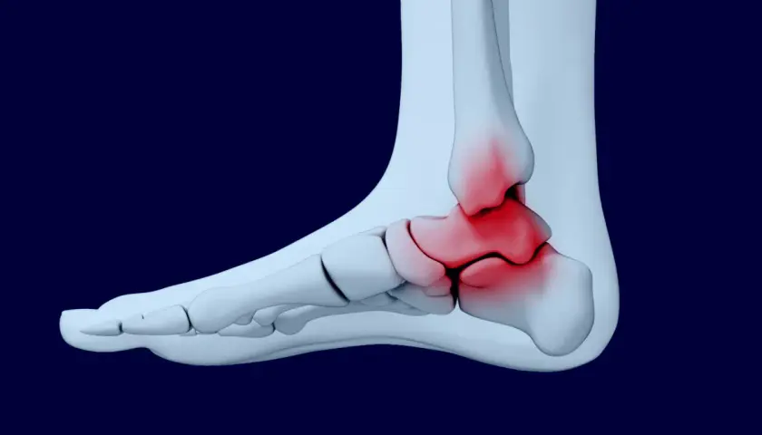 Anatomia stawu skokowego z zaznaczonym bólem. Może to być podstawa do ubiegania się o odszkodowanie za uraz, kod choroby s90.