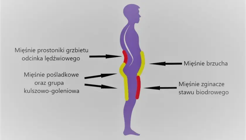 Schemat sylwetki z zaznaczonymi mięśniami. Widoczna pogłębiona lordoza lędźwiowa.
