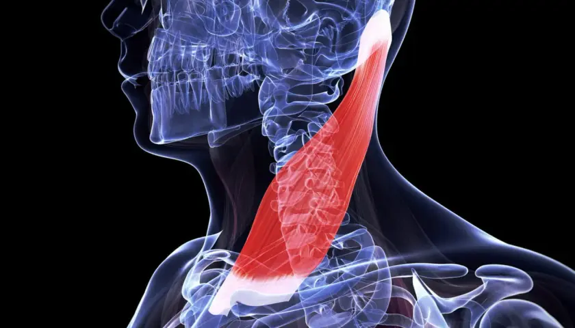 Anatomie du muscle sterno-cléido-mastoïdien, mis en évidence en rouge. Utile pour comprendre la douleur et le traitement associé.