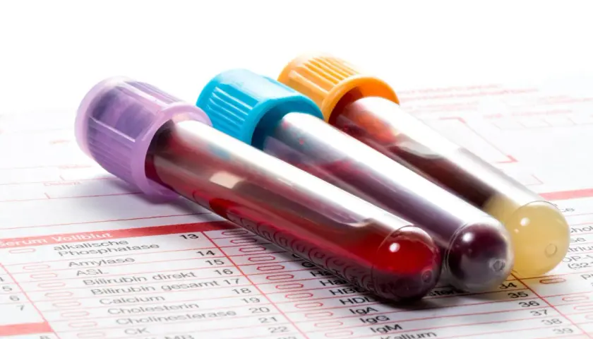 Probówki z krwią na tle formularza badań. Widać m.in. pozycję CRP, co to jest, jest kluczowe w diagnostyce.
