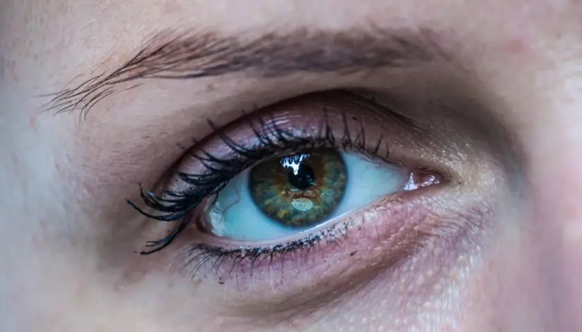 Nahaufnahme eines Auges mit einem leicht geschwollenen Augenlid. Die Iris ist grünlich-braun mit feinen Sprenkeln.