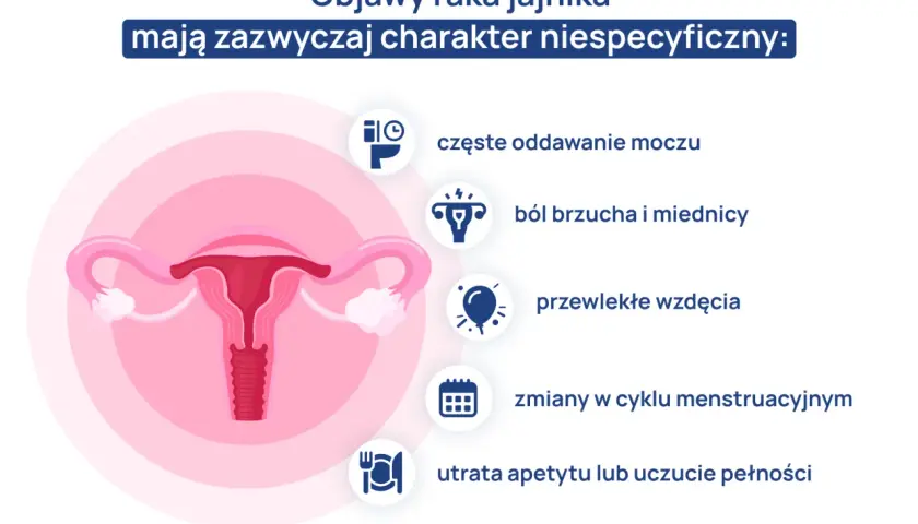 Ilustracja przedstawia narządy rodne kobiety i objawy raka jajnika: ból brzucha, wzdęcia, zmiany cyklu, częste oddawanie moczu, utratę apetytu.
