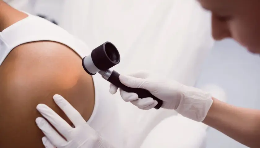 Dermatolog w białej rękawiczce bada skórę pacjenta dermatoskopem.