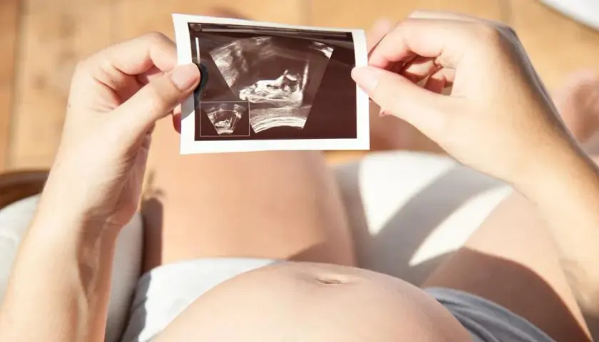 Kobieta trzyma zdjęcie USG płodu. Choć nie ma tu mowy o lewatywie ani jej skutkach ubocznych, obrazek symbolizuje początek nowego życia.