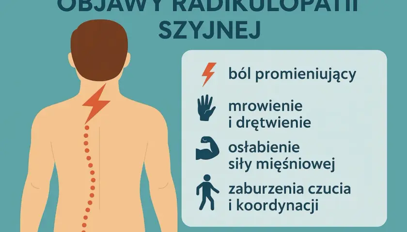 Objawy radikulopatii szyjnej: ból promieniujący, mrowienie, drętwienie, osłabienie mięśni, zaburzenia czucia. Ucisk na nerw błędny może objawiać się podobnie.