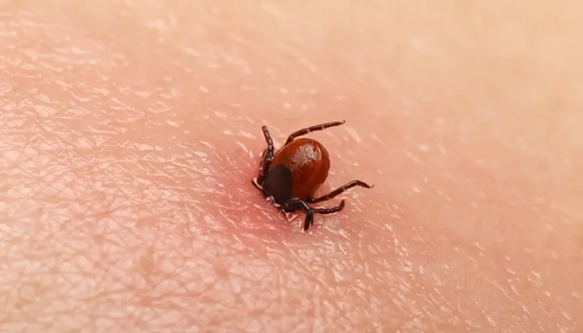 Objawy po ukąszeniu kleszcza: Kiedy szukać pomocy? Poradnik eksperta