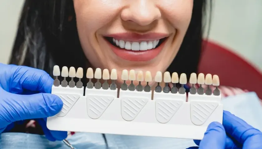 Uśmiechnięta kobieta z idealnymi zębami, dentysta dobiera kolor licówek. Sprawdź, jaka jest licówki cena.