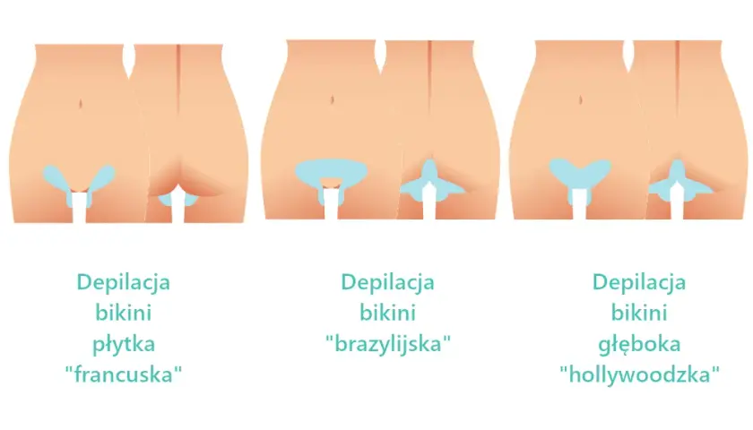 Depilacja bikini: Jak wygląda? Rodzaje, przebieg, porady ekspertki
