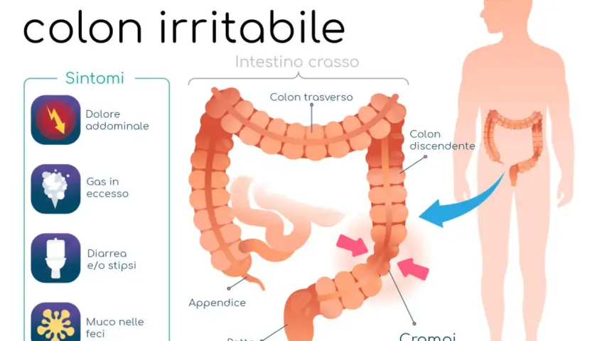 Illustrazione della sindrome del colon irritabile, con sintomi come dolore addominale, gas, diarrea/stipsi e muco. Evidenzia i crampi dolorosi.