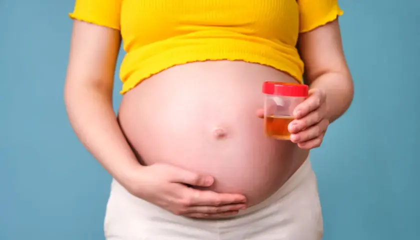 Ciężarna kobieta trzyma pojemnik z próbką moczu, badanie na obecność ketonów w moczu w ciąży.