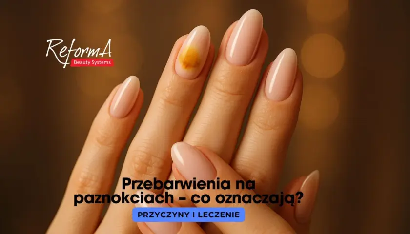 Pomarańczowe paznokcie: moda czy sygnał zdrowia?