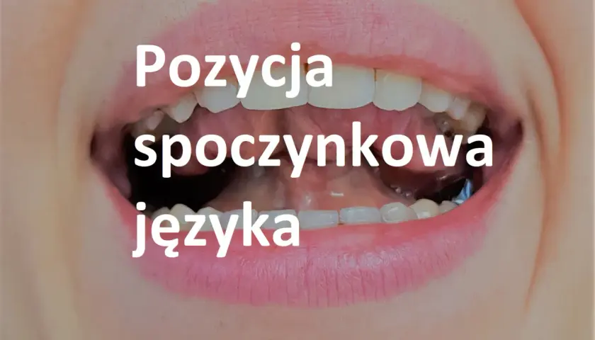 Zbliżenie na usta z widocznymi zębami, tekst "Pozycja spoczynkowa języka" sugeruje ćwiczenia miofunkcjonalne języka.
