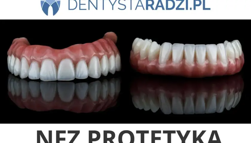 Dwa rodzaje protez zębowych, jedna z widocznym wstawieniem zęba jedynki na NFZ.