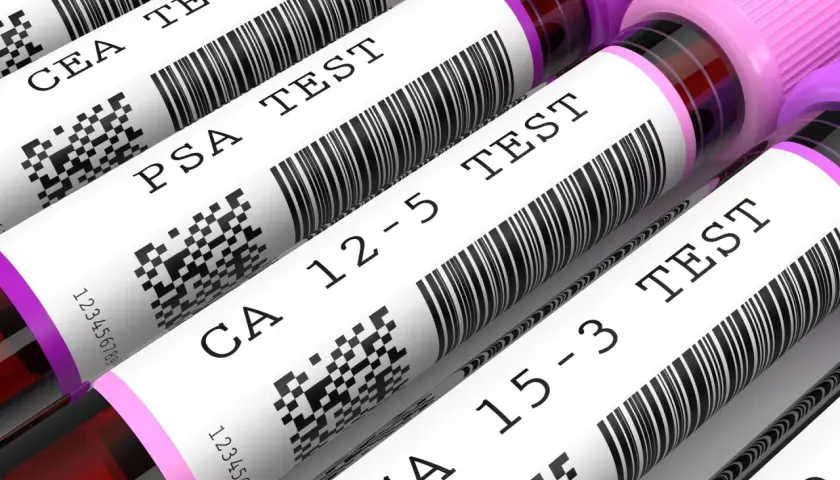Rząd probówek z próbkami krwi do badań, z etykietami: CEA TEST, PSA TEST, CA 12-5 TEST, CA 15-3 TEST.