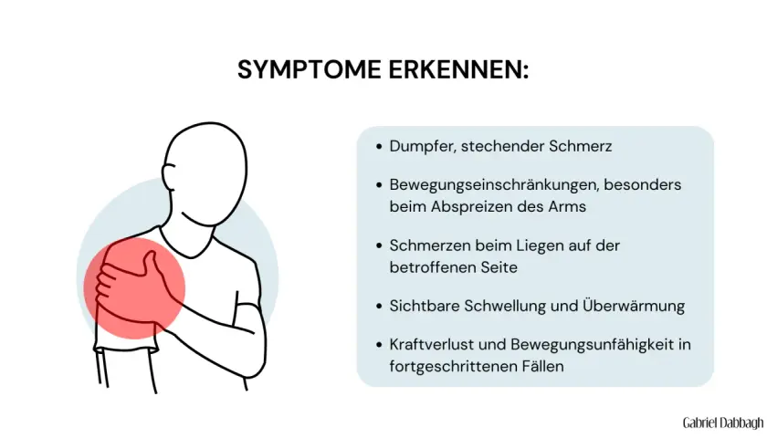 Schulter-Schleimbeutelentzündung: dumpfer Schmerz, Bewegungseinschränkung, Schwellung und Überwärmung der Schulter.