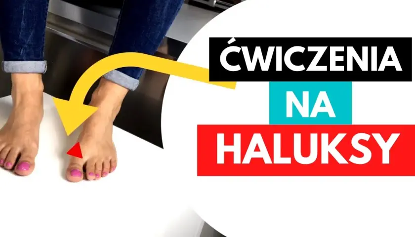Jak wyprostować haluksy? Metody, ćwiczenia i operacja - kompleksowy poradnik