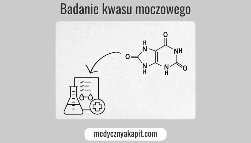 Badanie kwasu moczowego: schemat przedstawia wzór chemiczny kwasu moczowego i ikonę laboratoryjną z listą kontrolną, sugerując analizę i normę.