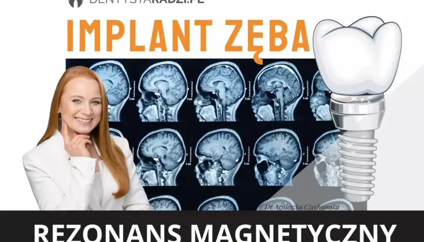 Rezonans magnetyczny a metal w zębie. Dr Agnieszka Czechumska wyjaśnia, czy implant zęba jest bezpieczny podczas rezonansu.