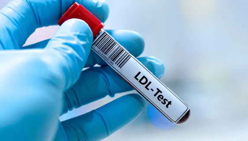 Ręka w niebieskiej rękawiczce trzyma probówkę z oznaczeniem "LDL-Test". Wynik badania wskazuje na podwyższony cholesterol LDL.