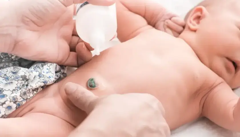 Delikatne czyszczenie pępka noworodka, aby zapobiec zapaleniu pępka. Dłoń aplikuje płyn z butelki na pępek.