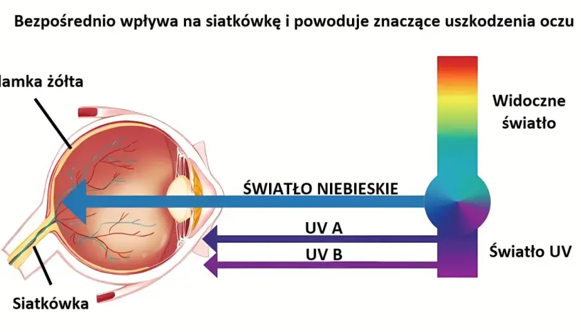 Czy telewizor emituje niebieskie światło? Sprawdź skutki dla zdrowia