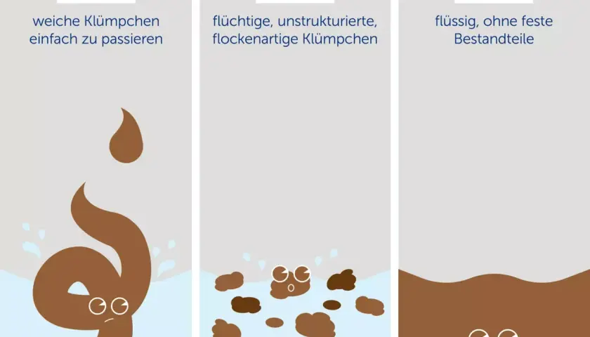 Darstellung von Durchfall-Typen. Typ 5 zeigt weiche Klümpchen, die auf einen perfekten Stuhlgang hindeuten könnten, im Gegensatz zu flüssigeren Formen.
