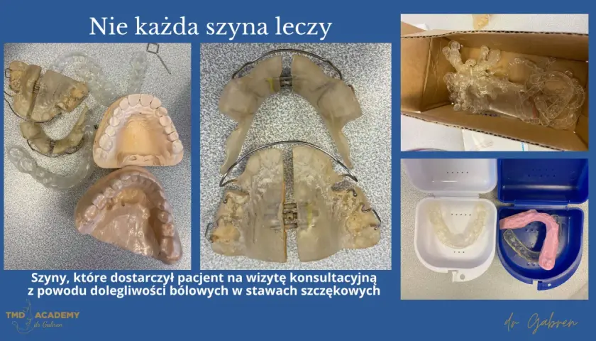 Szyny na zęby, modele szczęk i pudełka na ochraniacze. Pacjent przyniósł je z powodu bólu, co pokazuje, że bruksizm co to za problem, wymaga właściwego leczenia.
