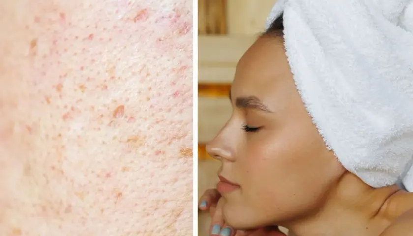 Tołpa serum rozświetlające: efekty, skład, opinie i cena