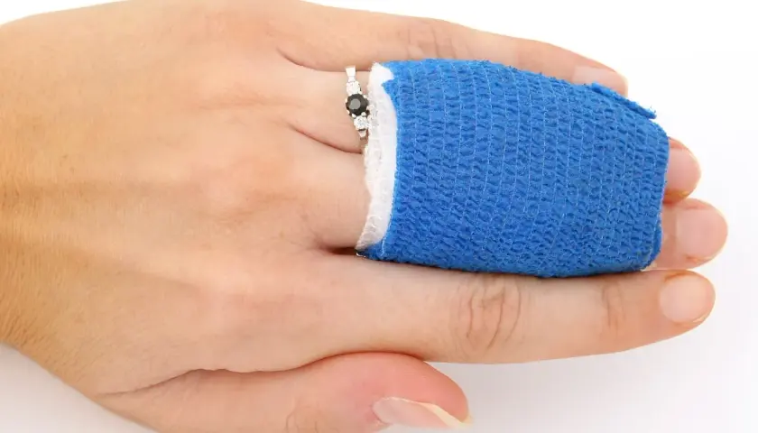 Zwichnięcie palca u ręki, opatrzony niebieskim bandażem, z pierścionkiem z czarnym kamieniem.