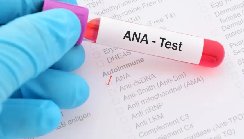 Badanie ANA - Test wykrywa przeciwciała przeciwjądrowe, kluczowe w diagnostyce chorób autoimmunologicznych.