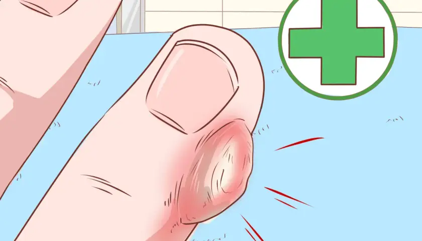 Gros plan d'un doigt enflammé avec une corne sur les mains, entouré d'un symbole médical vert.