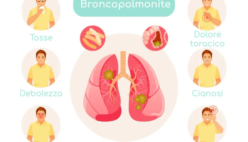 Illustrazione dei sintomi della broncopolmonite: tosse, debolezza, febbre, dolore toracico, cianosi e mal di testa.