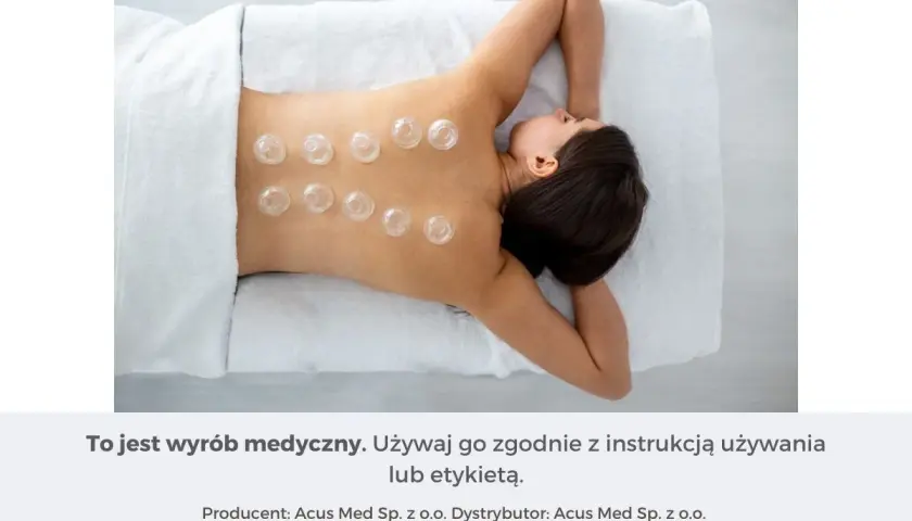 Kobieta z bańkami na plecach. Dowiedz się, jak stawiać bańki ogniowe, by poczuć ulgę.