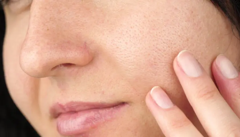 Gros plan sur une peau avec des pores visibles. Une main effleure la joue, suggérant une recherche de solutions pour comment enlever l'excès de sebum visage naturellement.