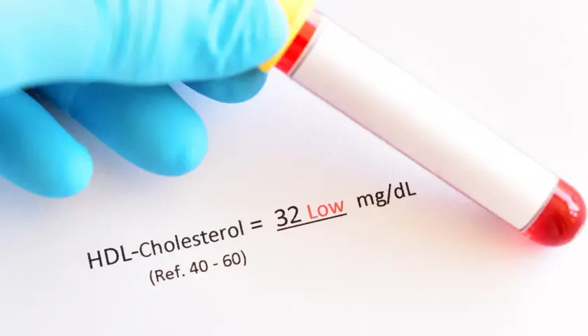 Wynik HDL-Cholesterolu to 32 mg/dL, co jest niskim wynikiem. Pamiętaj o zdrowym stylu życia, by utrzymać prawidłowy poziom **pitamet**.