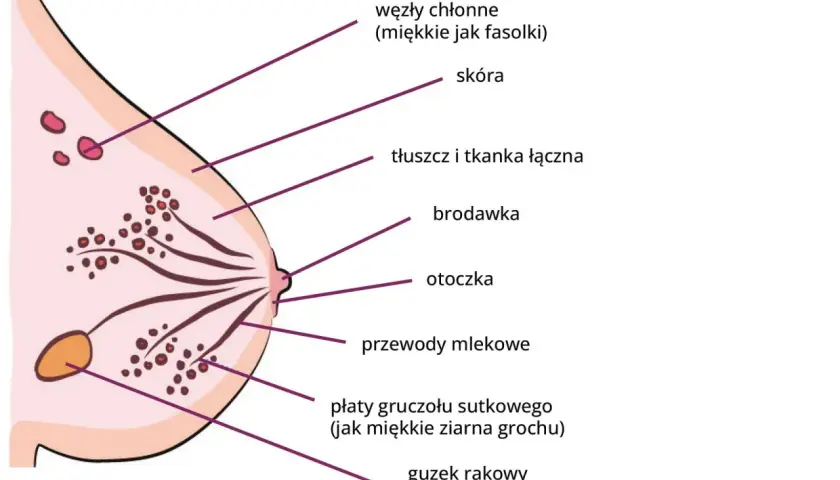 Schemat budowy piersi z zaznaczonymi elementami: skóra, brodawka, przewody mlekowe, płaty gruczołu sutkowego, węzły chłonne i guzek rakowy.