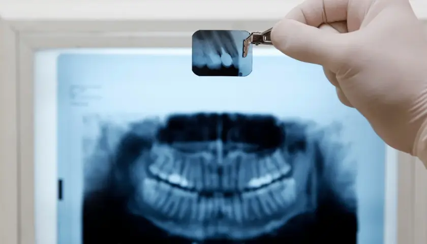 Rtg zęba jak odczytać? Dentysta trzyma małe zdjęcie RTG, analizując je na tle większego obrazu szczęki.