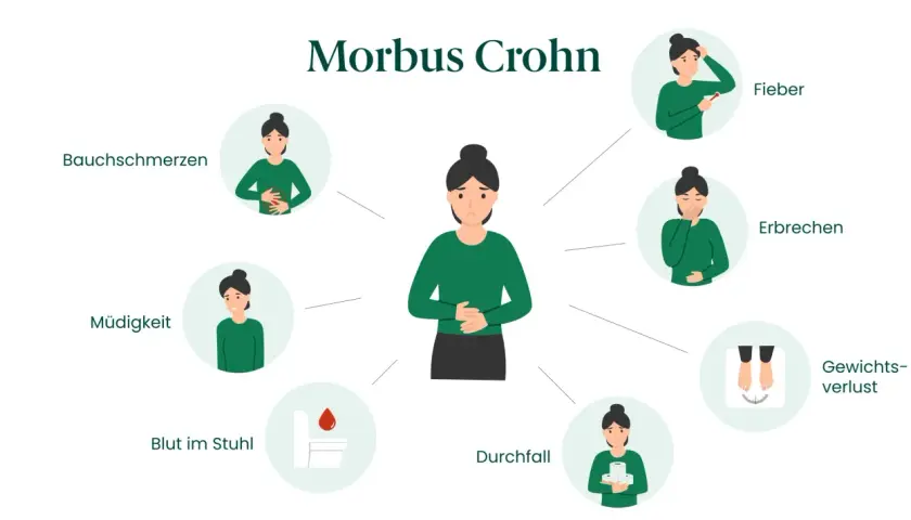 Illustration zeigt typische Morbus Crohn Symptome bei einer Frau: Bauchschmerzen, Müdigkeit, Blut im Stuhl, Durchfall, Fieber, Erbrechen, Gewichtsverlust.