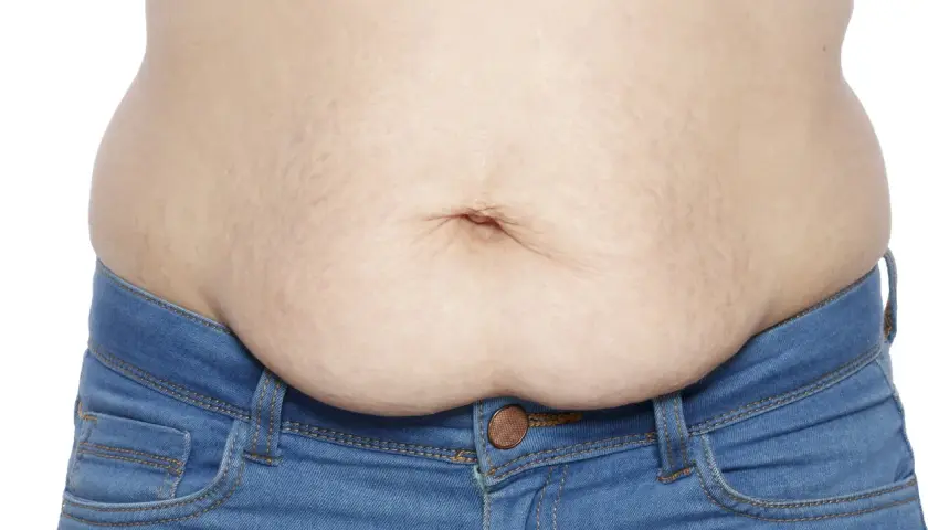En mage med slapp hud efter viktnedgång, med synliga bristningar och en navel. Bär blå jeans.