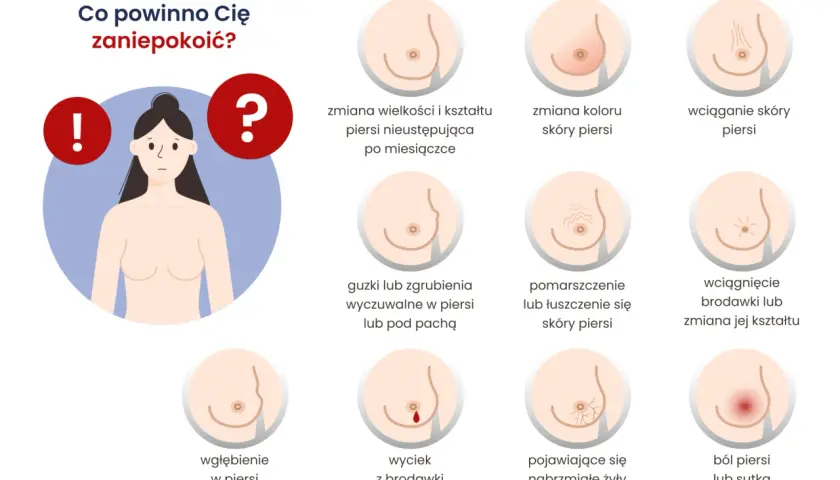 Grafika pokazuje objawy, które mogą świadczyć o raku piersi: zmiany wielkości, koloru, wciągnięcie skóry, guzki, wyciek z brodawki, ból.