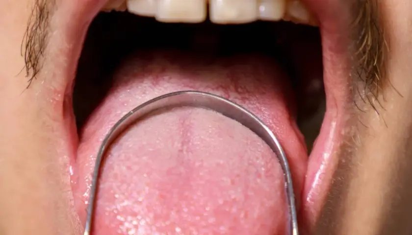 Lingua rosa con strumento metallico, evidenziando le papille gustative pronte a percepire sapori.